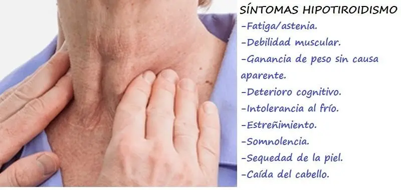 Hipotiroidismo síntomas: Signos comunes a conocer 4 Lista de sintomas