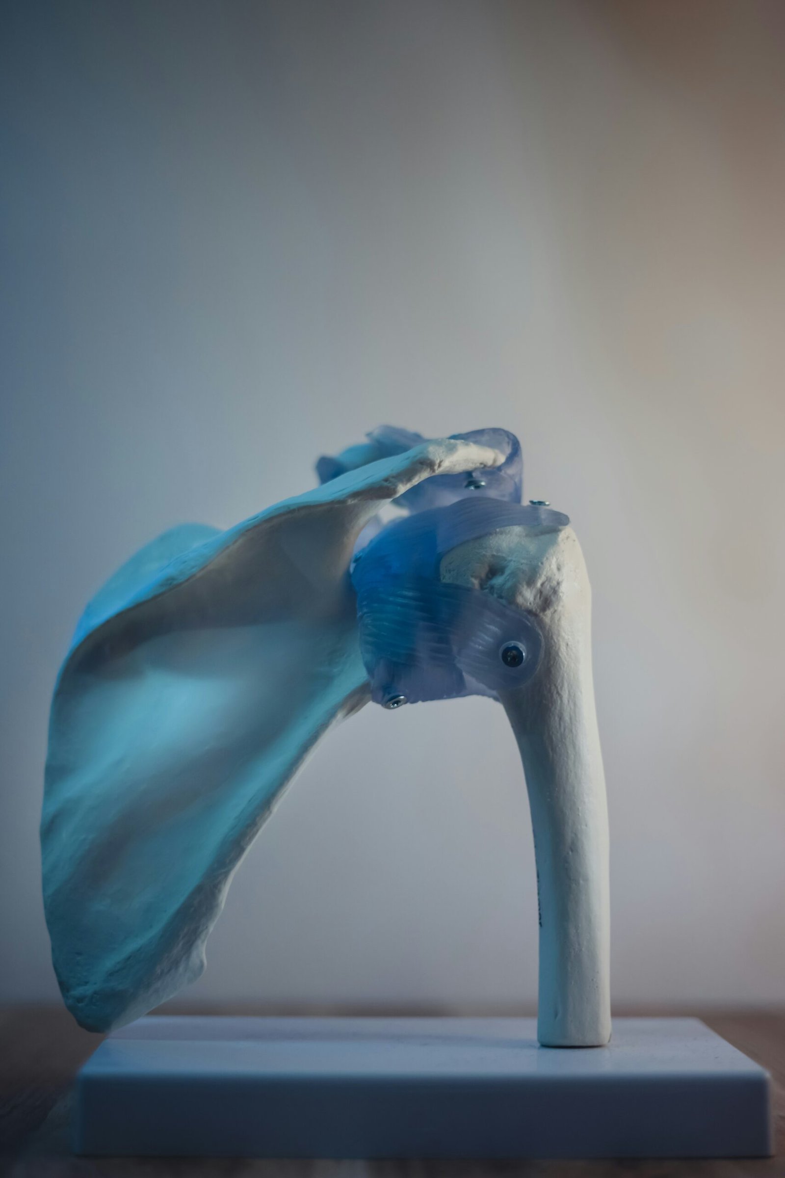 Dolor de Huesos: Causas y Enfermedades Asociadas 1 blue and white bird figurine